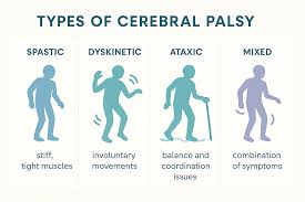 Cerebral Palsy